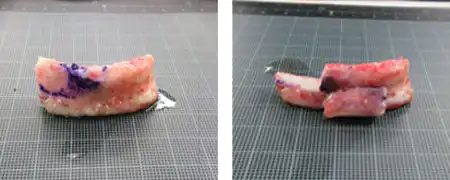 取り出した挙上用の肋軟骨ブロック