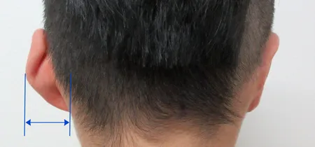 背面から見た耳の角度