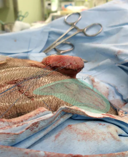 再建した耳介の角度